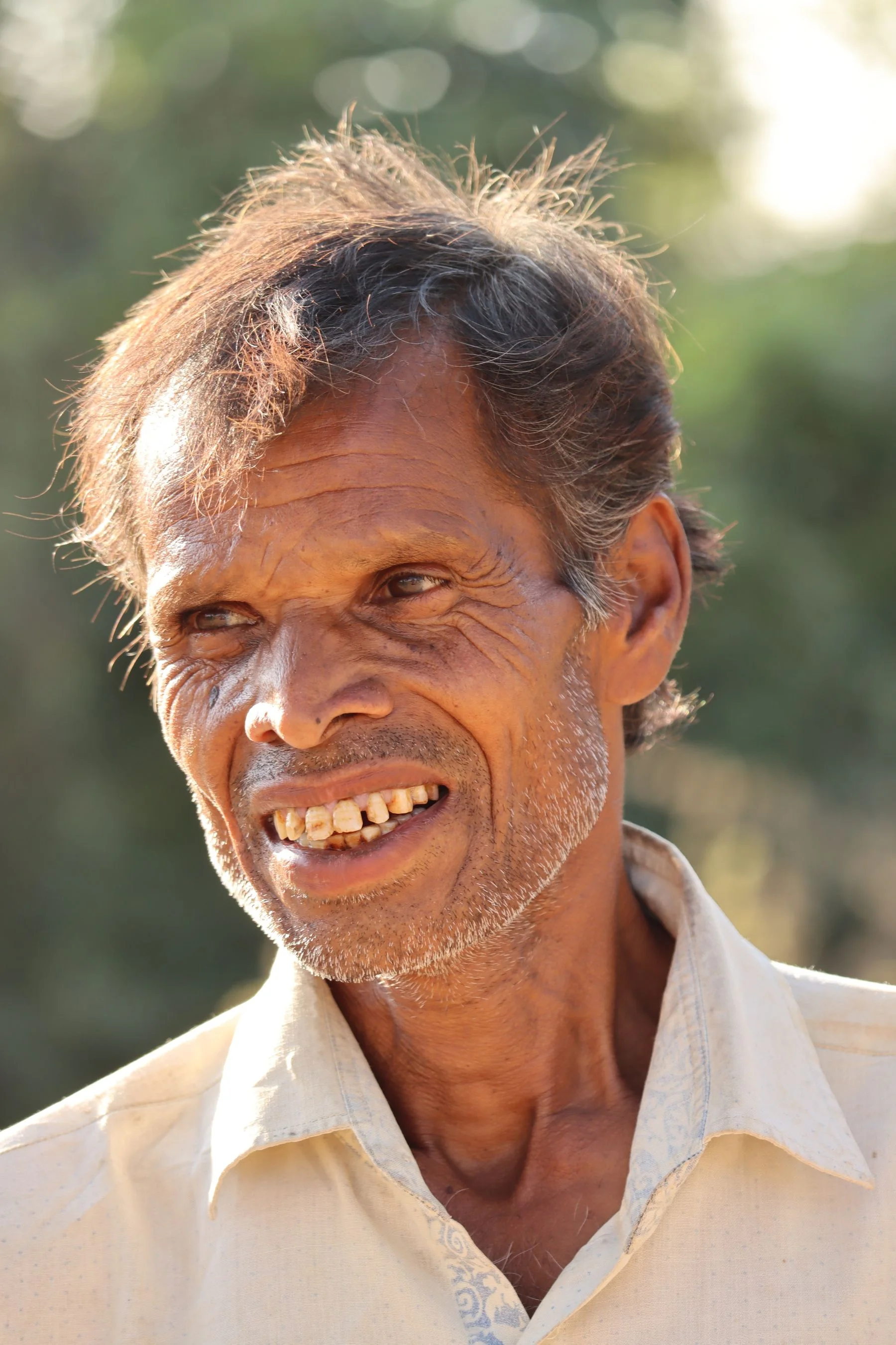 Adult considering options for missing teeth