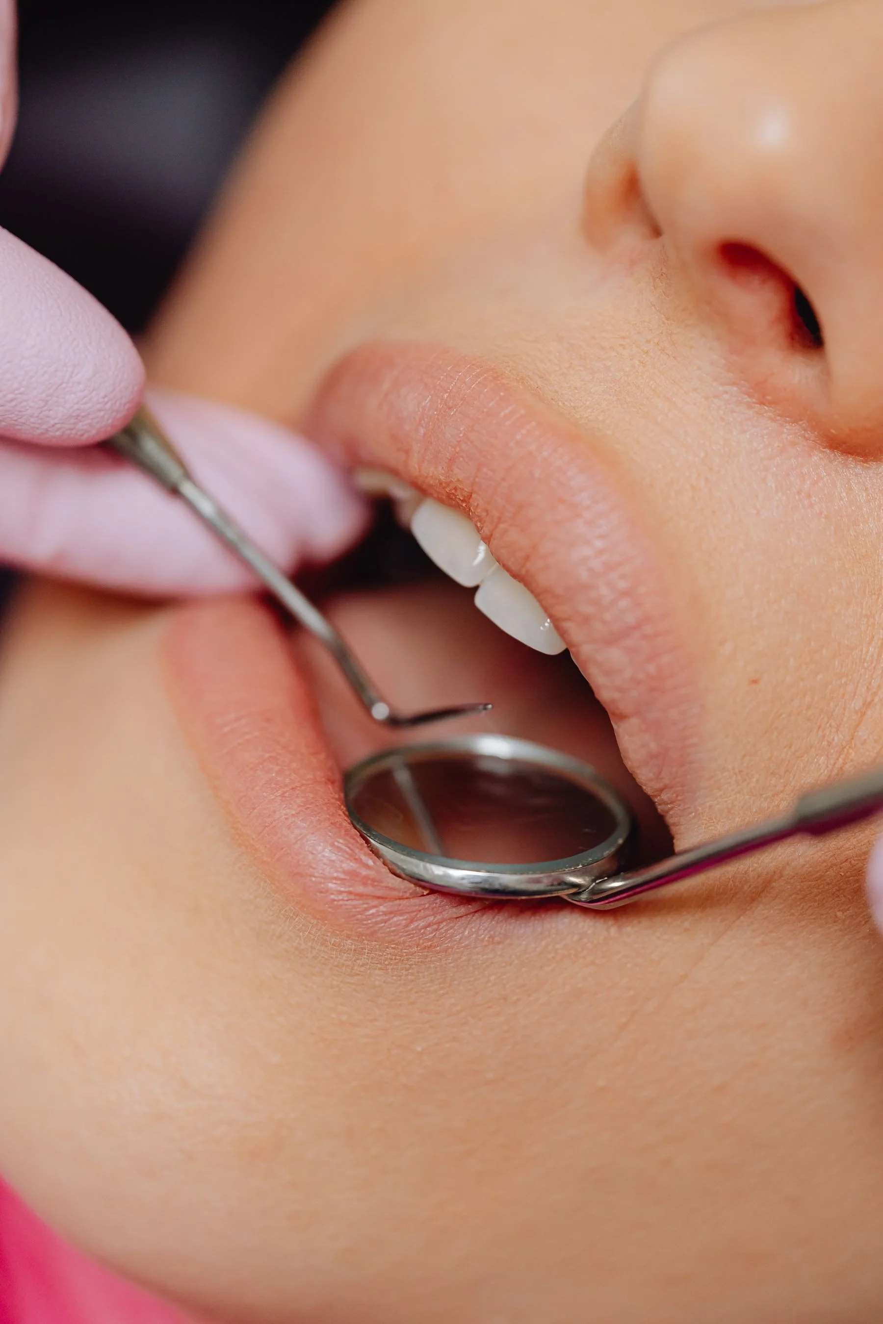 Dental examination tools