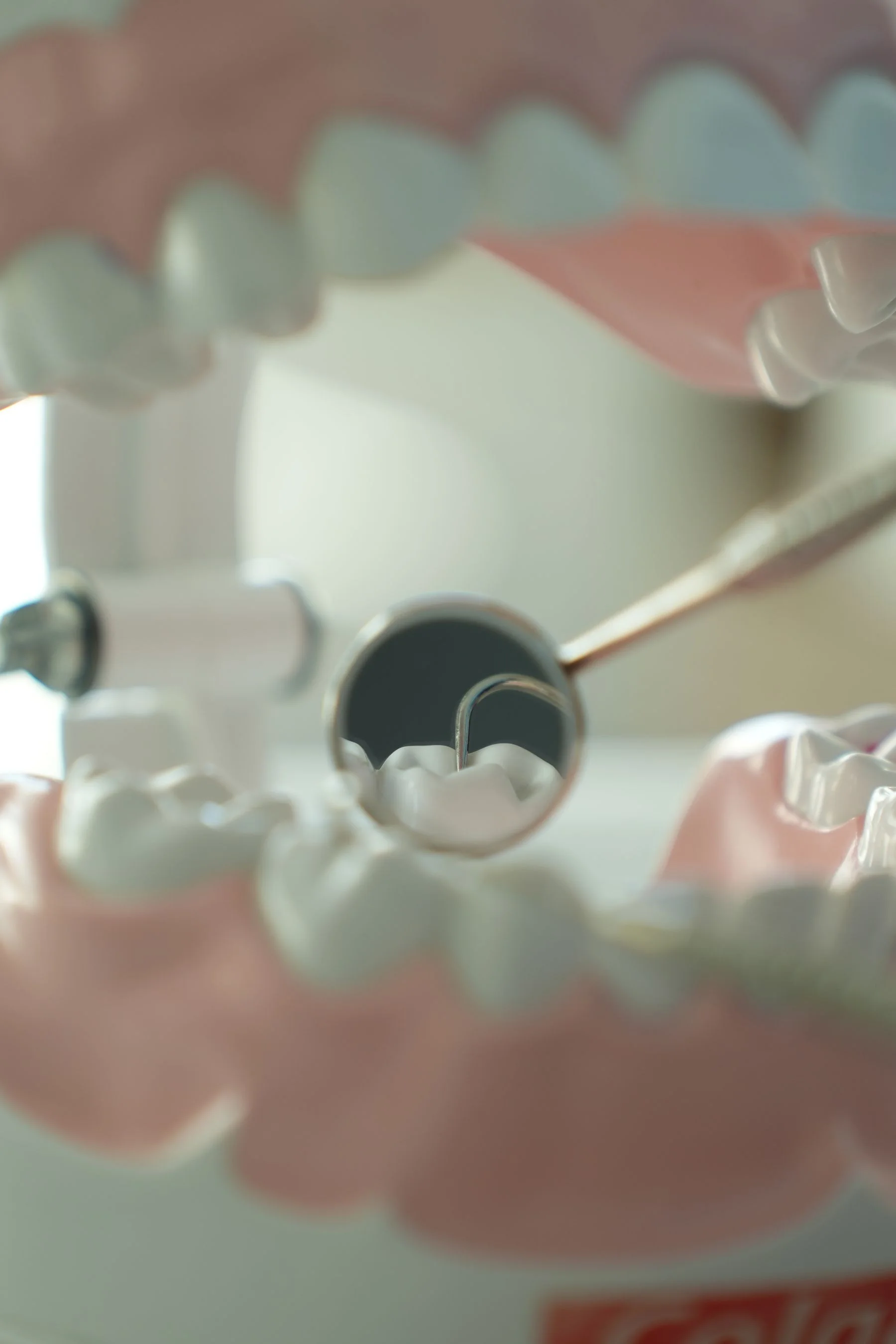 Detailed implant model